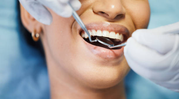 Best Emergency Dental Extractions in Colfax, IL